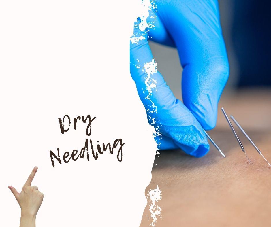 dry needling